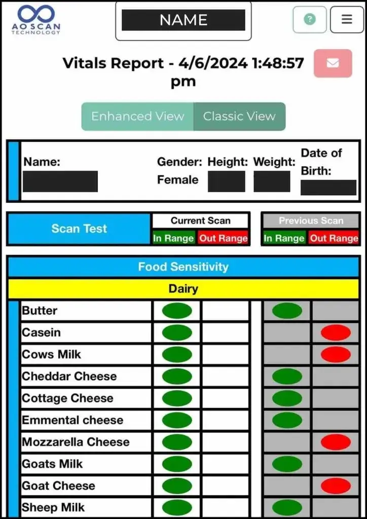 AO Scan Vitals Report